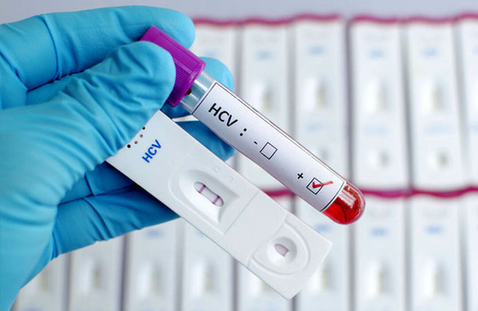 Epatite C: in Sardegna 3 milioni di euro per screening hcv da Regione e assessorato